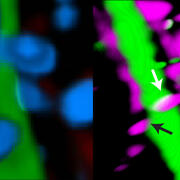 ALTTEXT