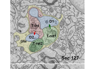 P14 Glomerulus