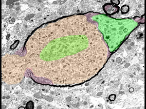 Myelin Bulb 1
