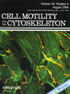 Actin filament binding by a monomeric IQGAP1 fragment with a single calponin homology domain