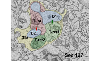 P14 Glomerulus