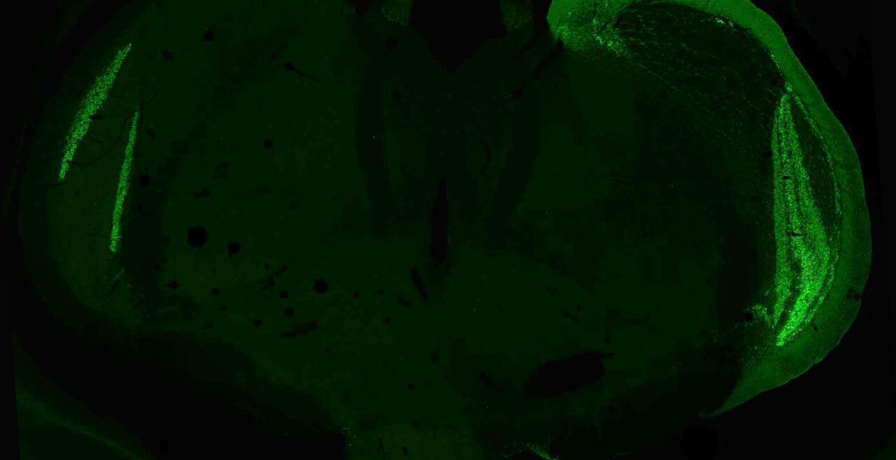 retina projections 